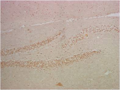 NF-KB p65 (5A10) Mouse mAb ABZ3910