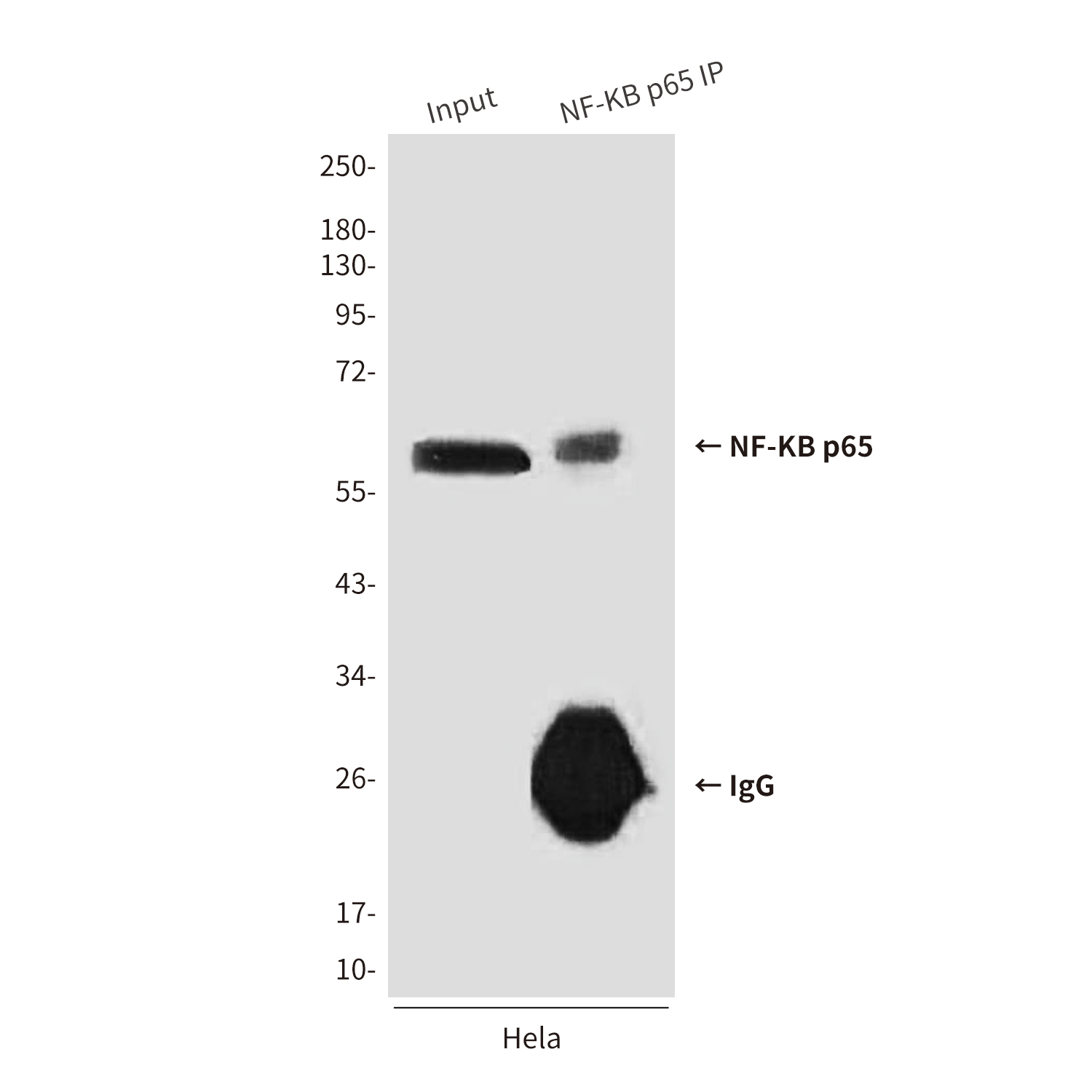 NF-KB p65 (5A10) Mouse mAb ABZ3910