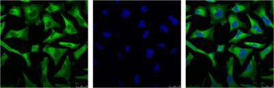 NF-KB p65 (3D2) Mouse mAb ABZ3911