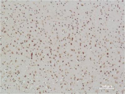 NF-KB p65 (3D2) Mouse mAb ABZ3911