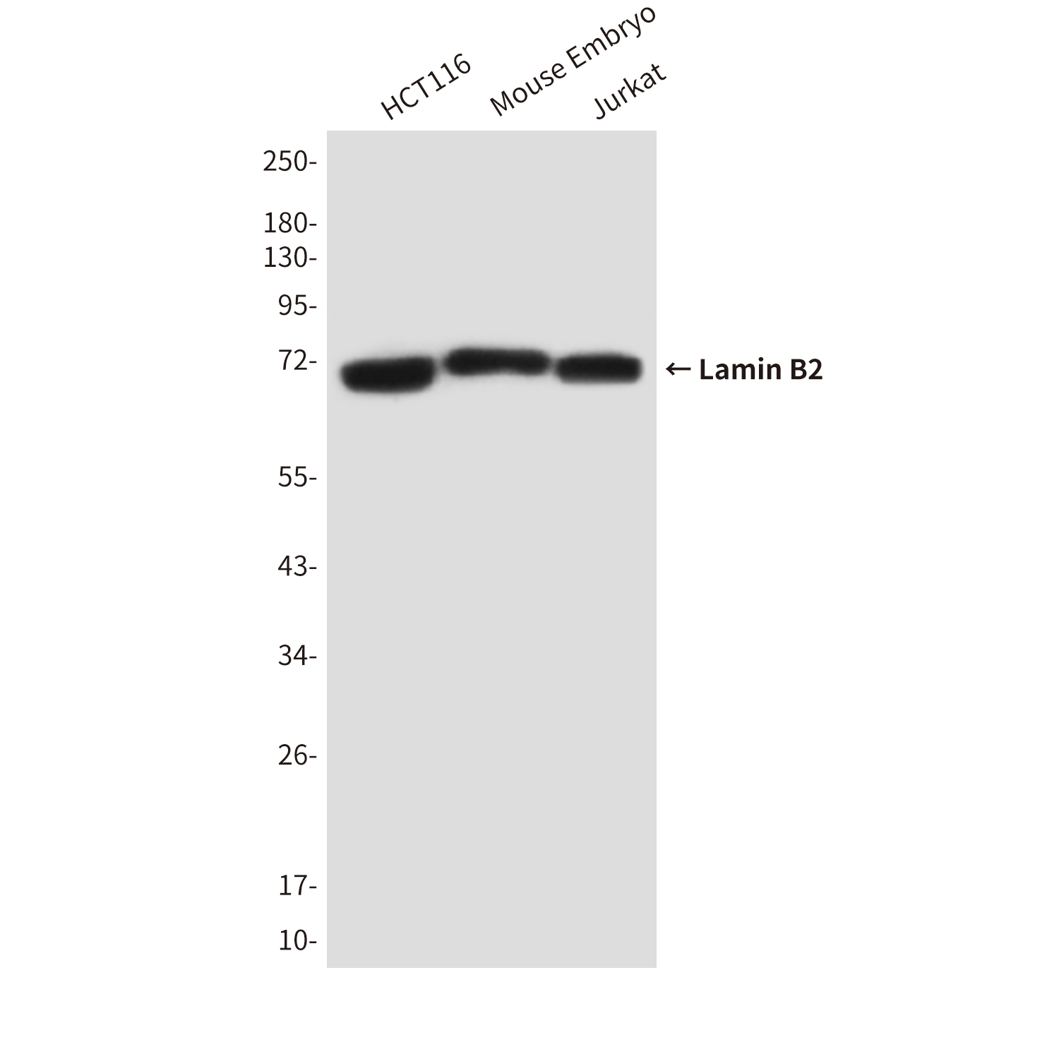 Lamin B2 (8F6) Mouse mAb ABZ3912