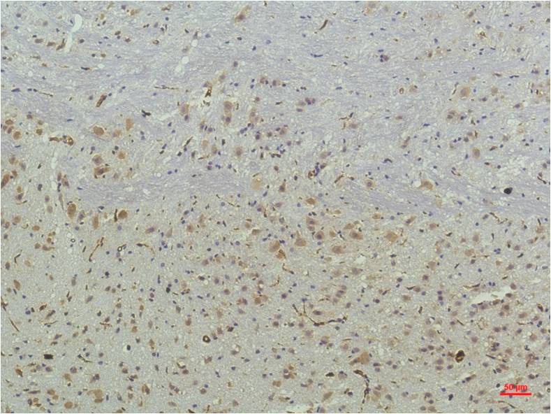PPAR delta (4G5) Mouse mAb ABZ3913