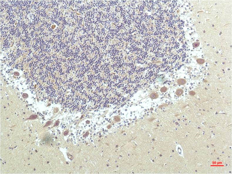 PPAR delta (4F4) Mouse mAb ABZ3914