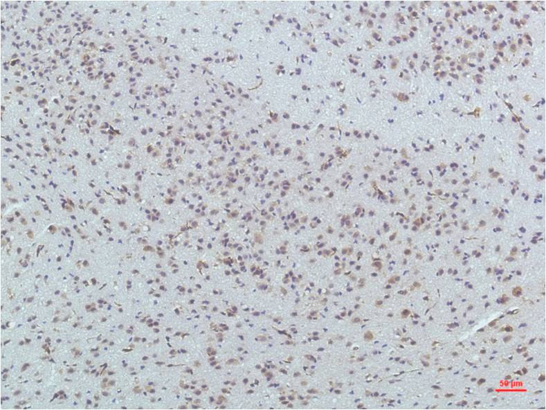 PPAR delta (4F4) Mouse mAb ABZ3914