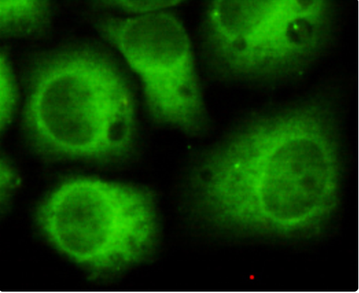 CDK5 (2E8) Mouse mAb ABZ3917