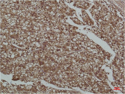 Smad3 (4H4) Mouse mAb ABZ3920