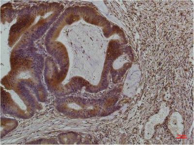 Smad3 (4H4) Mouse mAb ABZ3920
