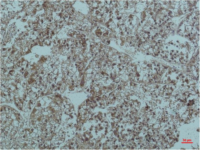 Smad2/3 (6F7) Mouse mAb ABZ3921