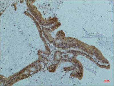 Smad2/3 (6F7) Mouse mAb ABZ3921