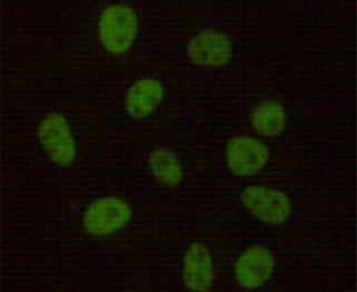 DNA PKcs (6D1) Mouse mAb ABZ3922