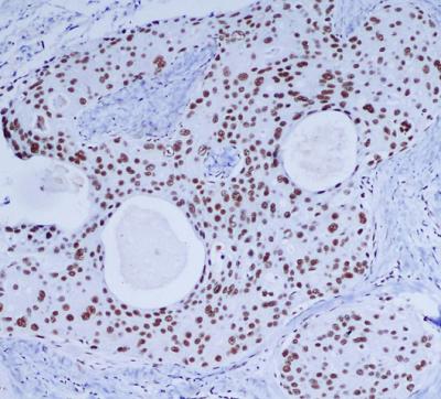 DNA PKcs (6D1) Mouse mAb ABZ3922