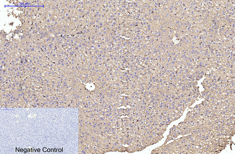 ACTA1 (2B10) Mouse mAb ABZ3926
