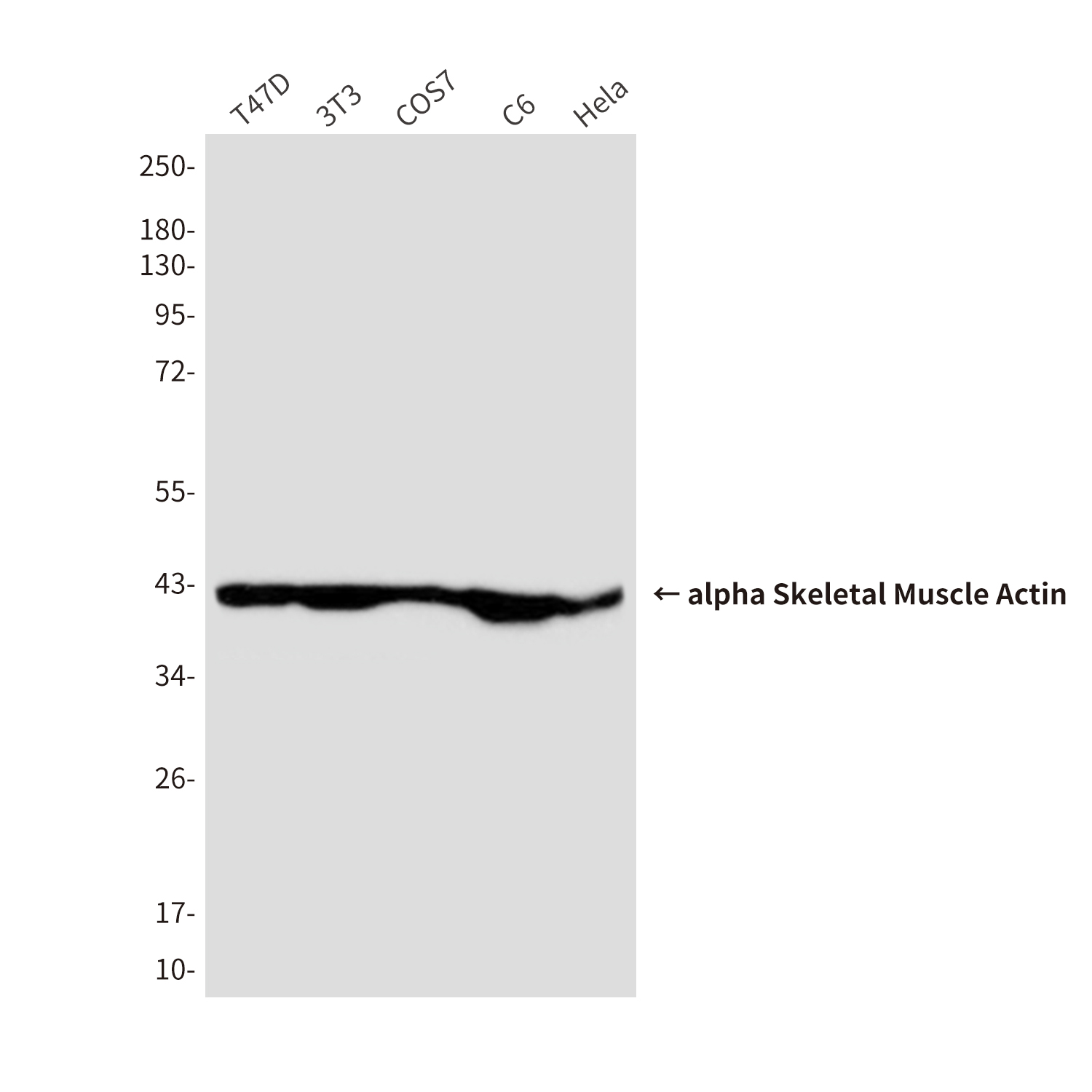 ACTA1 (2B10) Mouse mAb ABZ3926