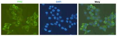 RPS6 (7B10) Mouse mAb ABZ3928