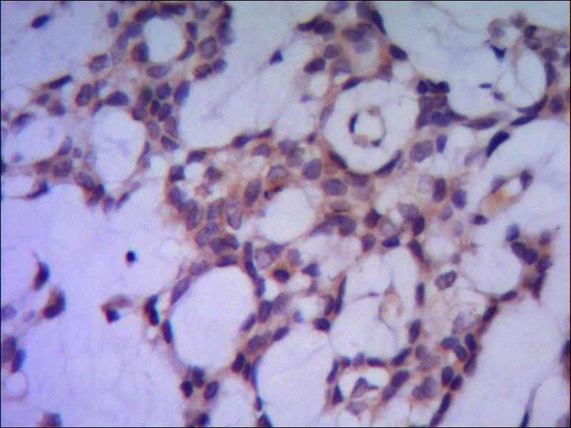 PP1C alpha (1C11) Mouse mAb ABZ3930