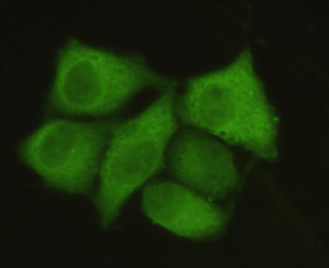 PP1C alpha (1H1) Mouse mAb ABZ3931