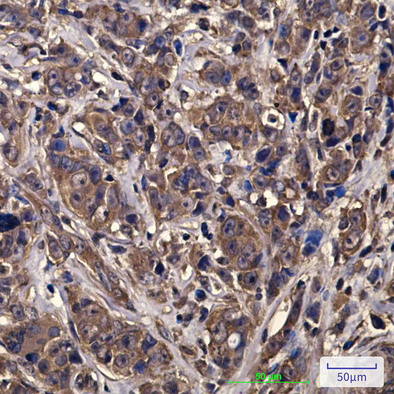 eIF4A1 (6D7) Mouse mAb ABZ3933
