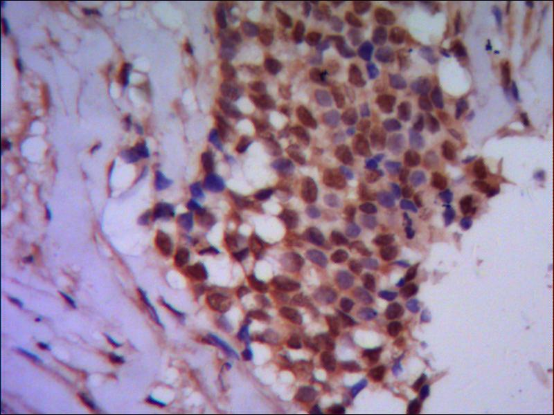 PPP4C (2F11) Mouse mAb ABZ3934
