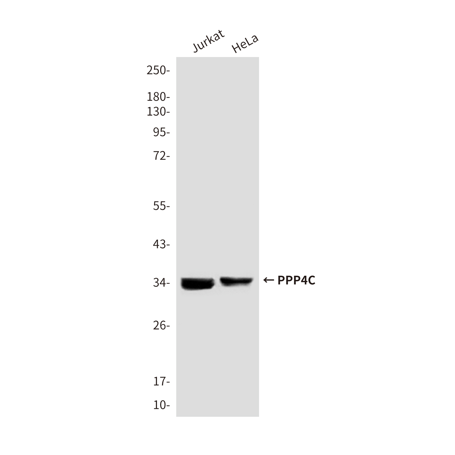 PPP4C (2F11) Mouse mAb ABZ3934