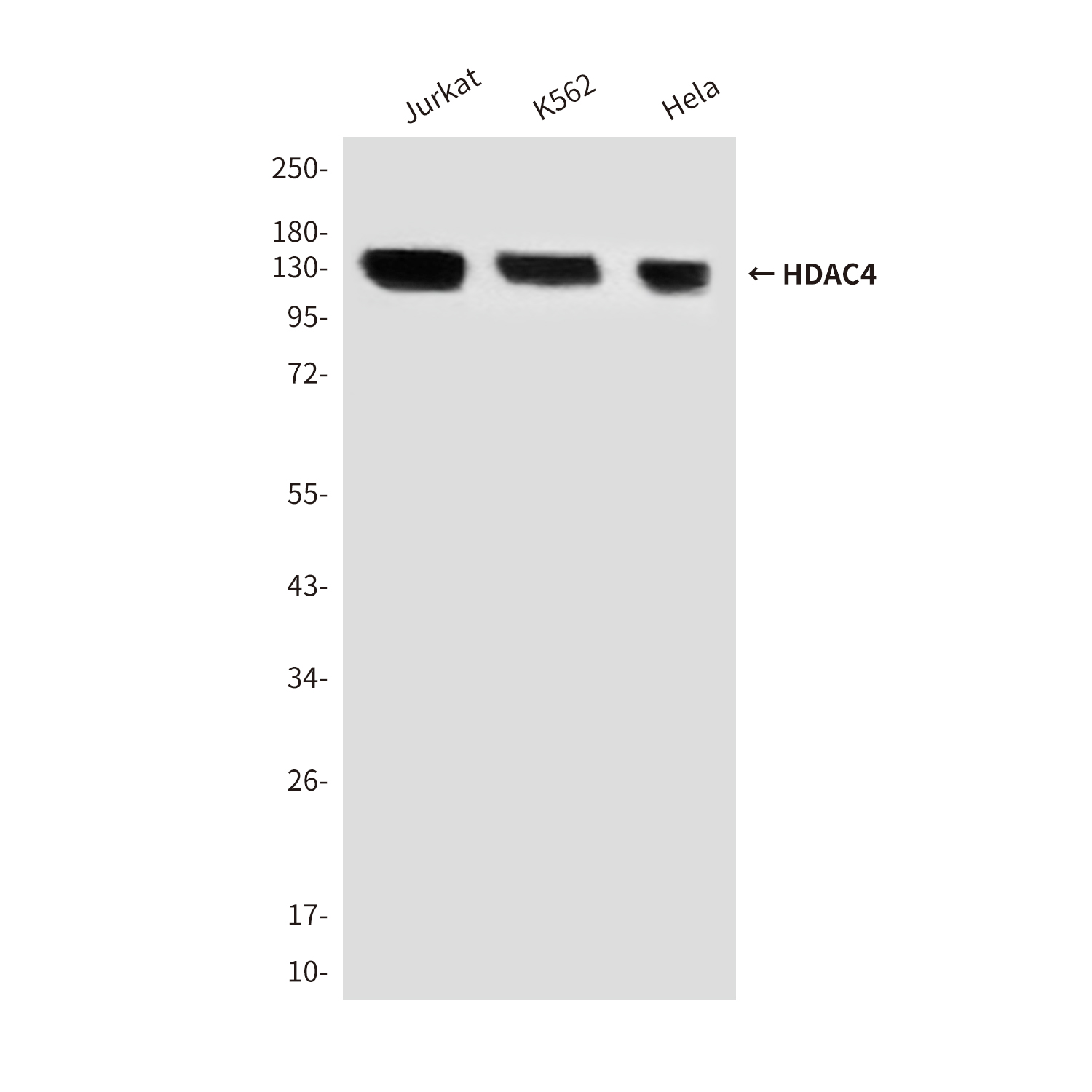 HDAC4 (4A3) Mouse mAb ABZ3937