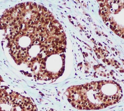 hHR23B (5H1) Mouse mAb ABZ3939