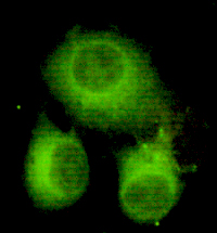 ATP Citrate Lyase (3D9) Mouse mAb ABZ3940