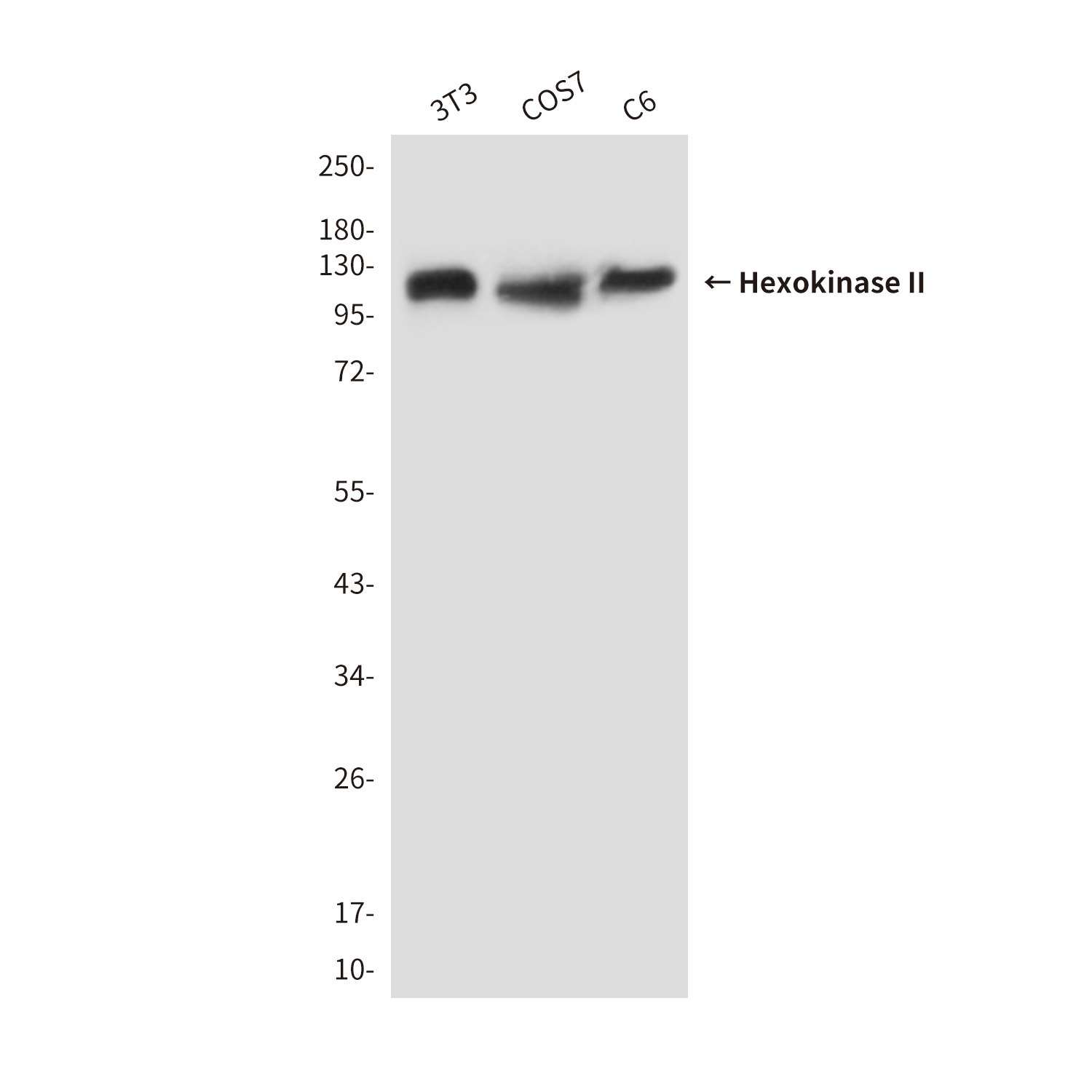 Hexokinase II (1E8) Mouse mAb ABZ3942