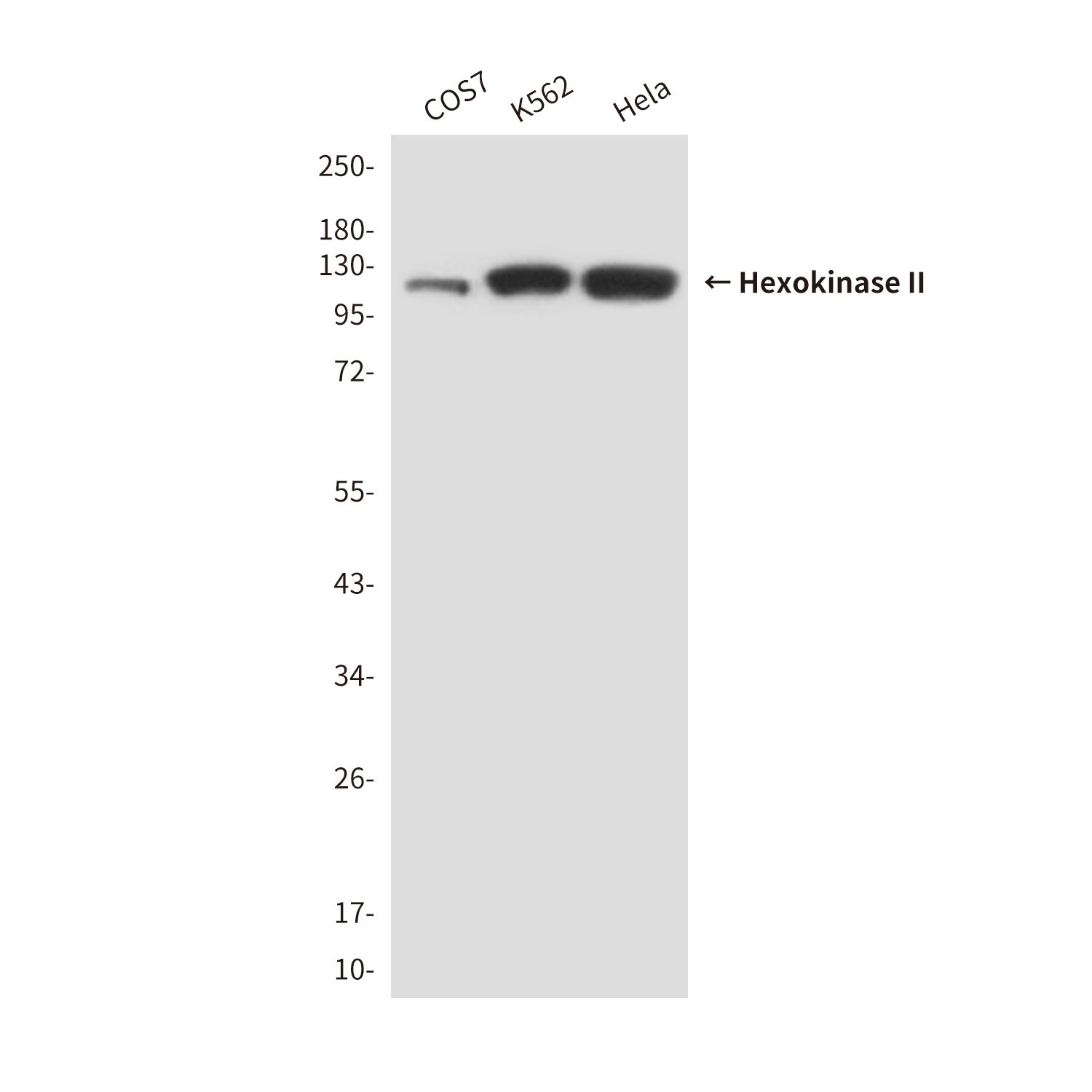 Hexokinase II (3B9) Mouse mAb ABZ3943