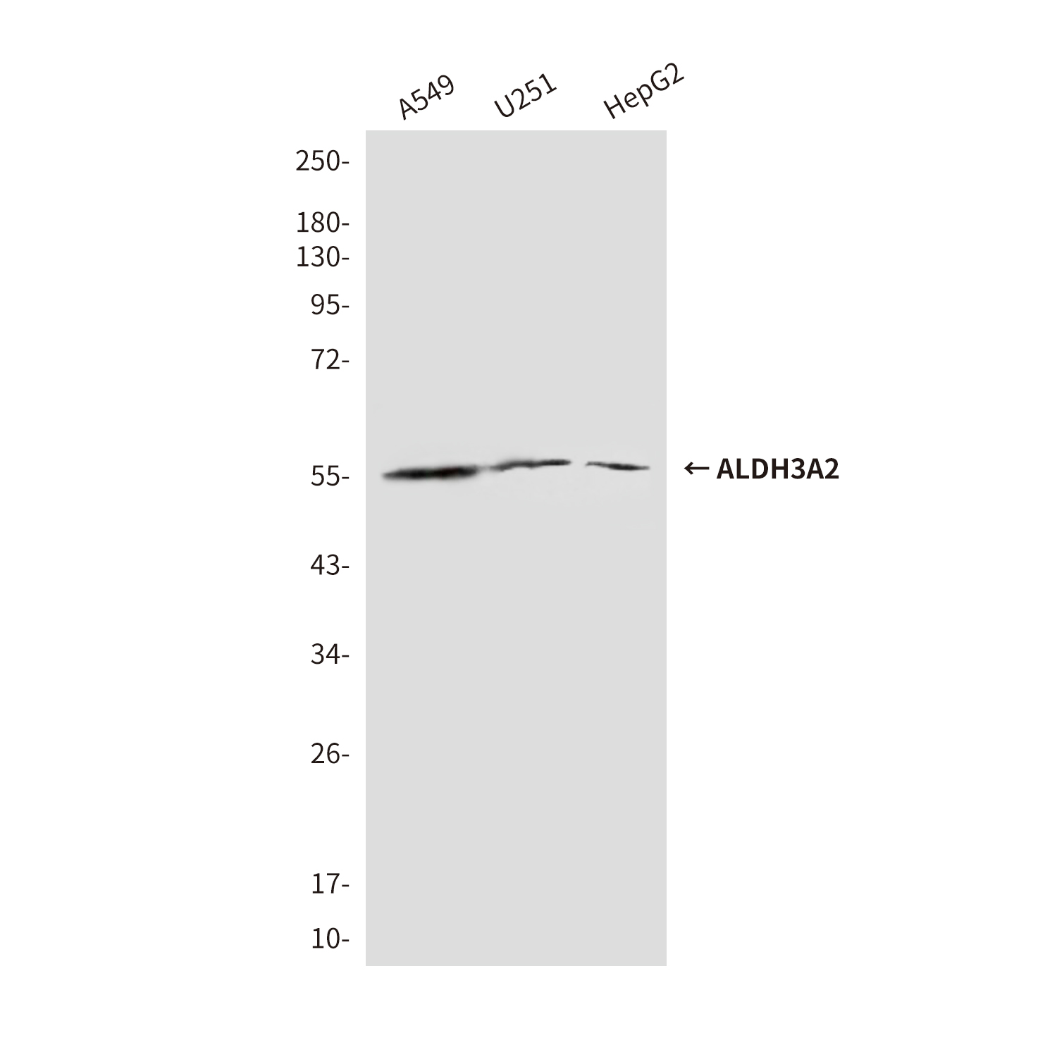 Aldehyde dehydrogenase 10 Mouse mAb ABZ3947