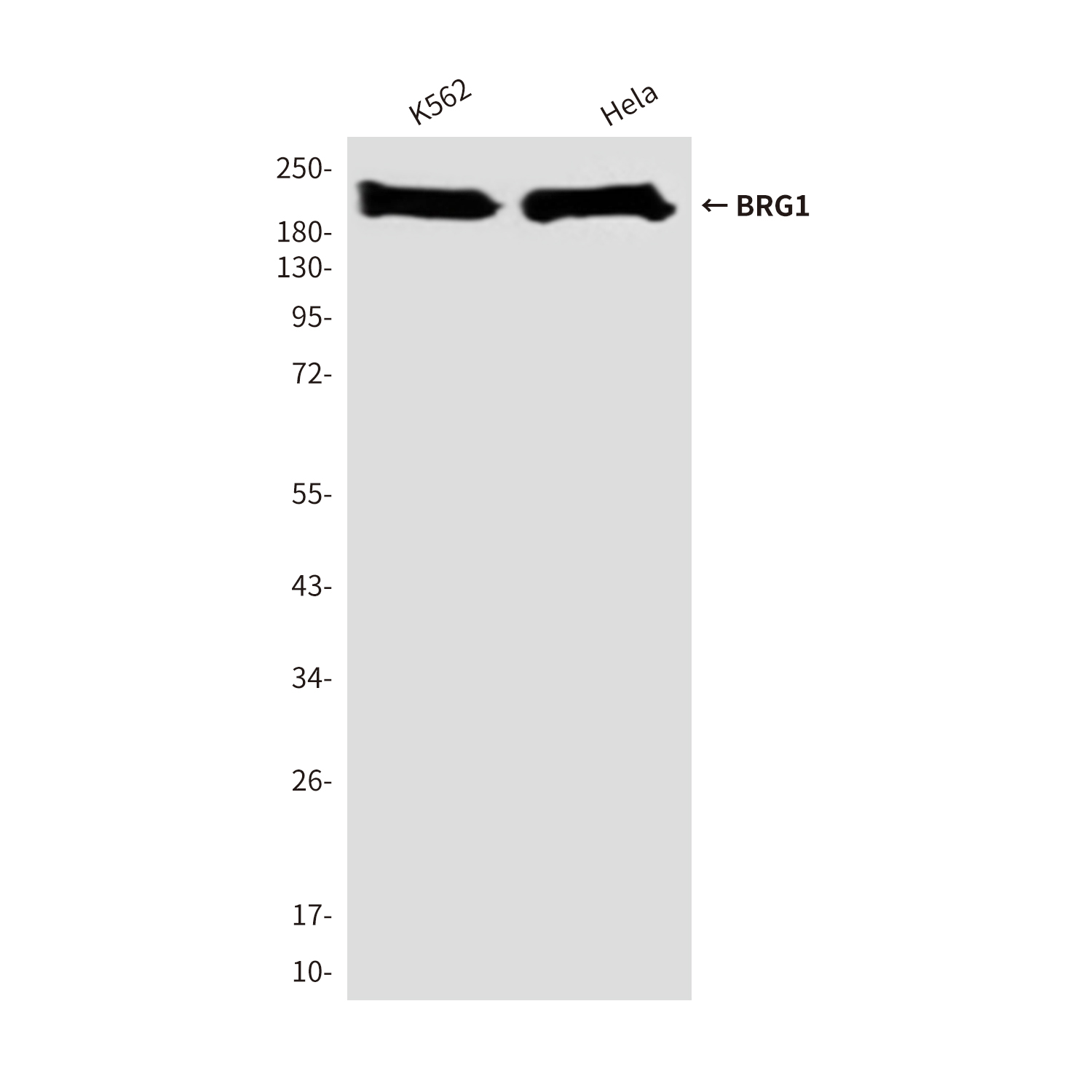 BRG1 (4E11) Mouse mAb ABZ3948