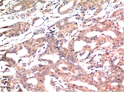 GSK3 beta (9F9) Mouse mAb ABZ3950