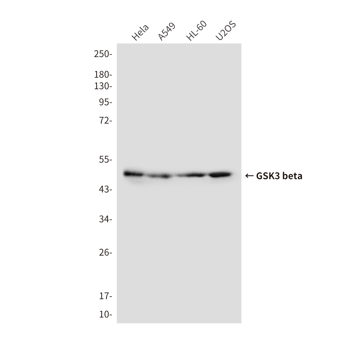 GSK3 beta (9F9) Mouse mAb ABZ3950