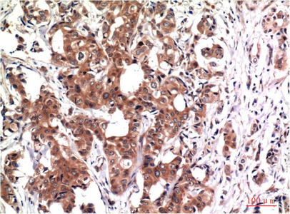 GSK3 beta (9B1) Mouse mAb ABZ3951