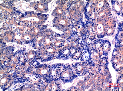 GSK3 beta (9B1) Mouse mAb ABZ3951