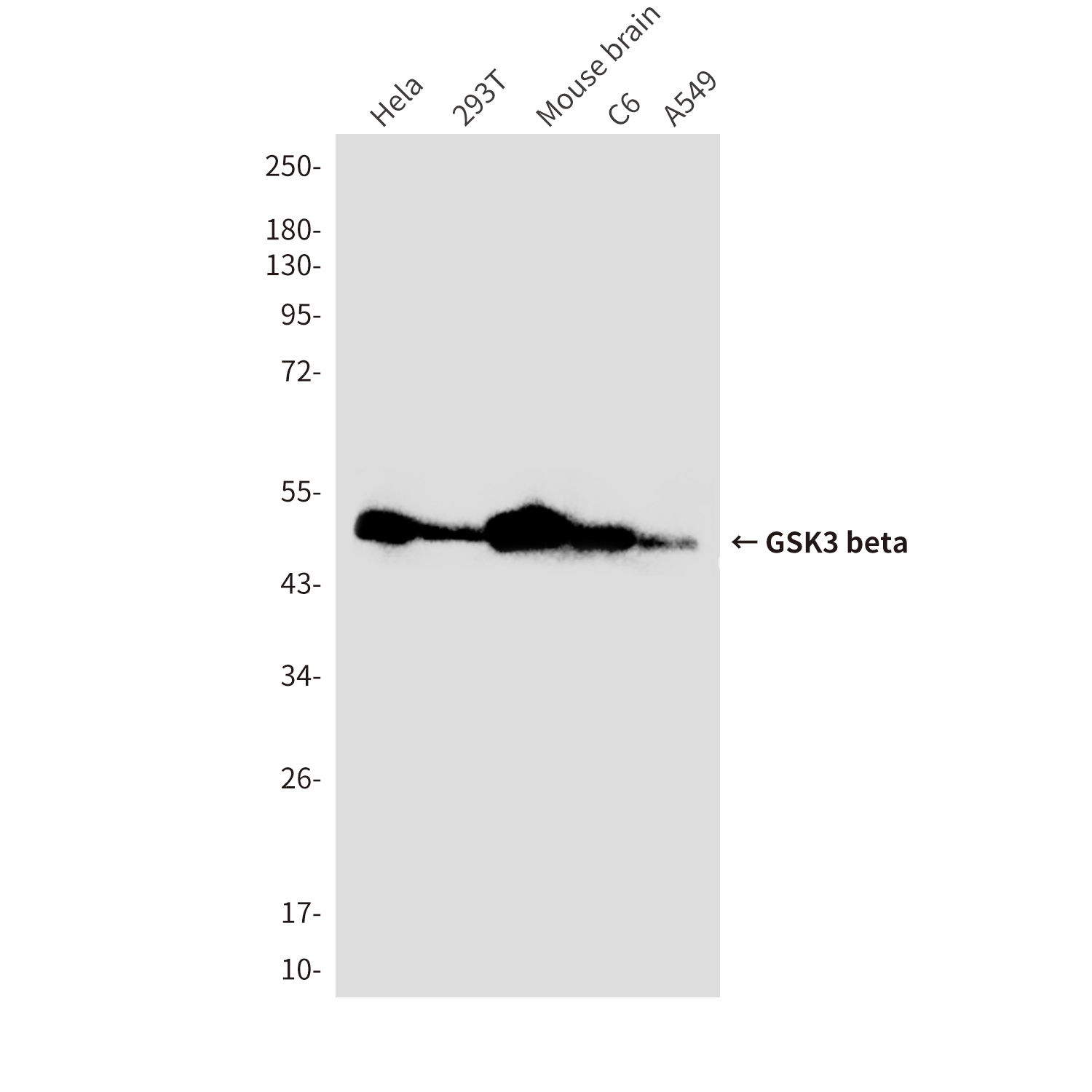 GSK3 beta (9B1) Mouse mAb ABZ3951