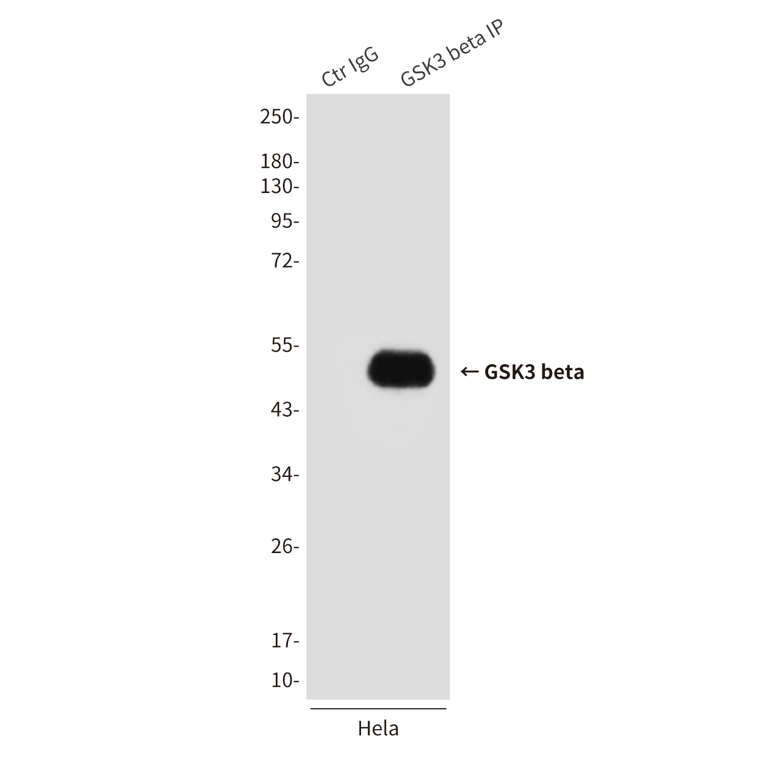 GSK3 beta (2E6) Mouse mAb ABZ3952