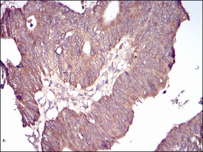 GSK3 beta Mouse mAb ABZ3953