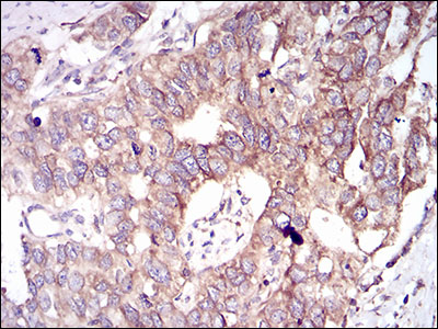 GSK3 beta Mouse mAb ABZ3953