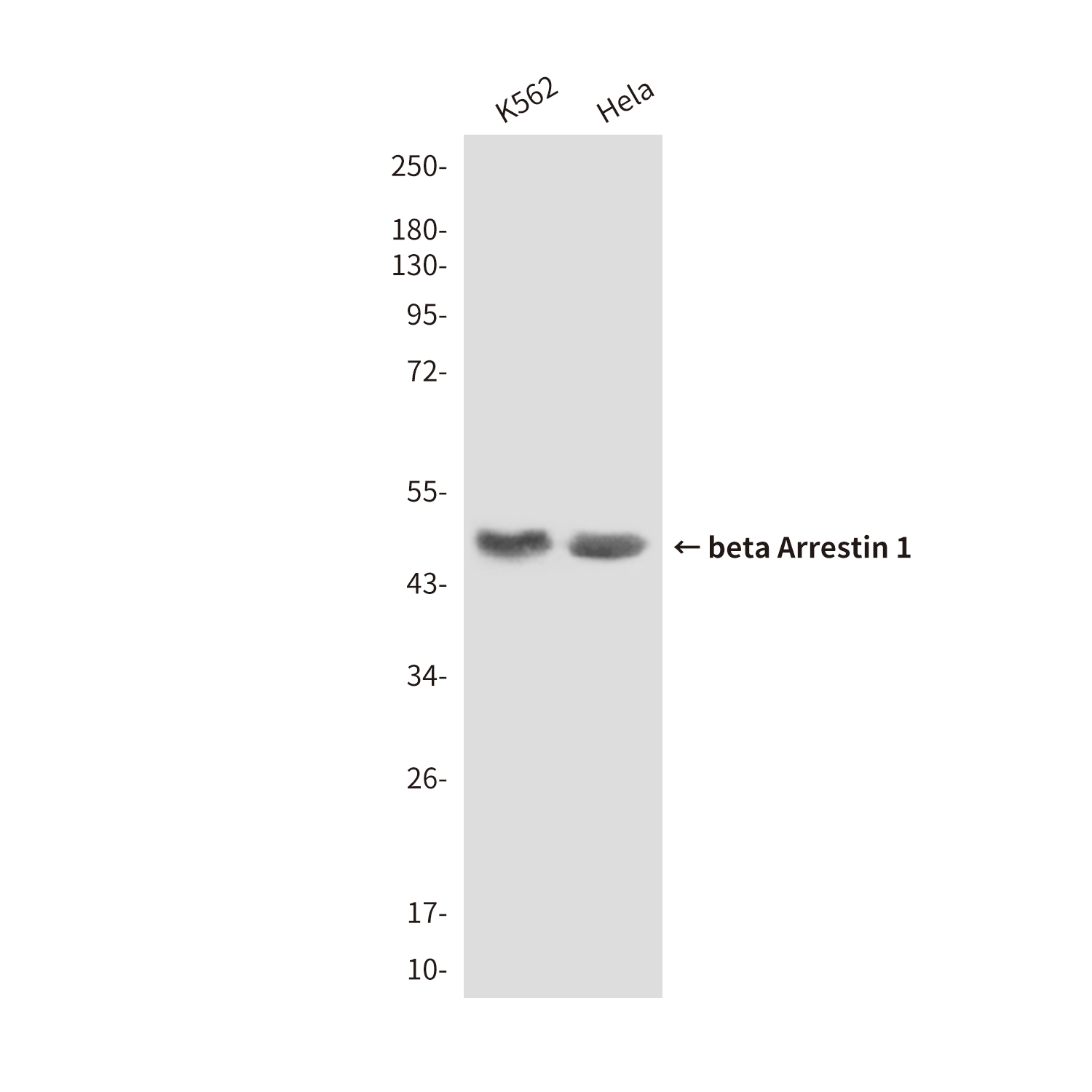 beta Arrestin 1 (6A1) Mouse mAb ABZ3955