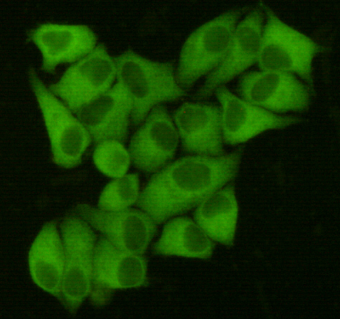 Fatty Acid Synthase (6B9) Mouse mAb ABZ3956