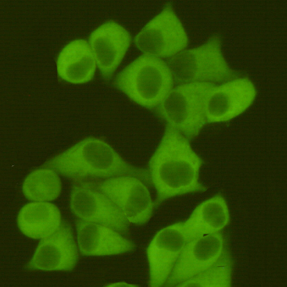 Fatty Acid Synthase (2F9) Mouse mAb ABZ3957