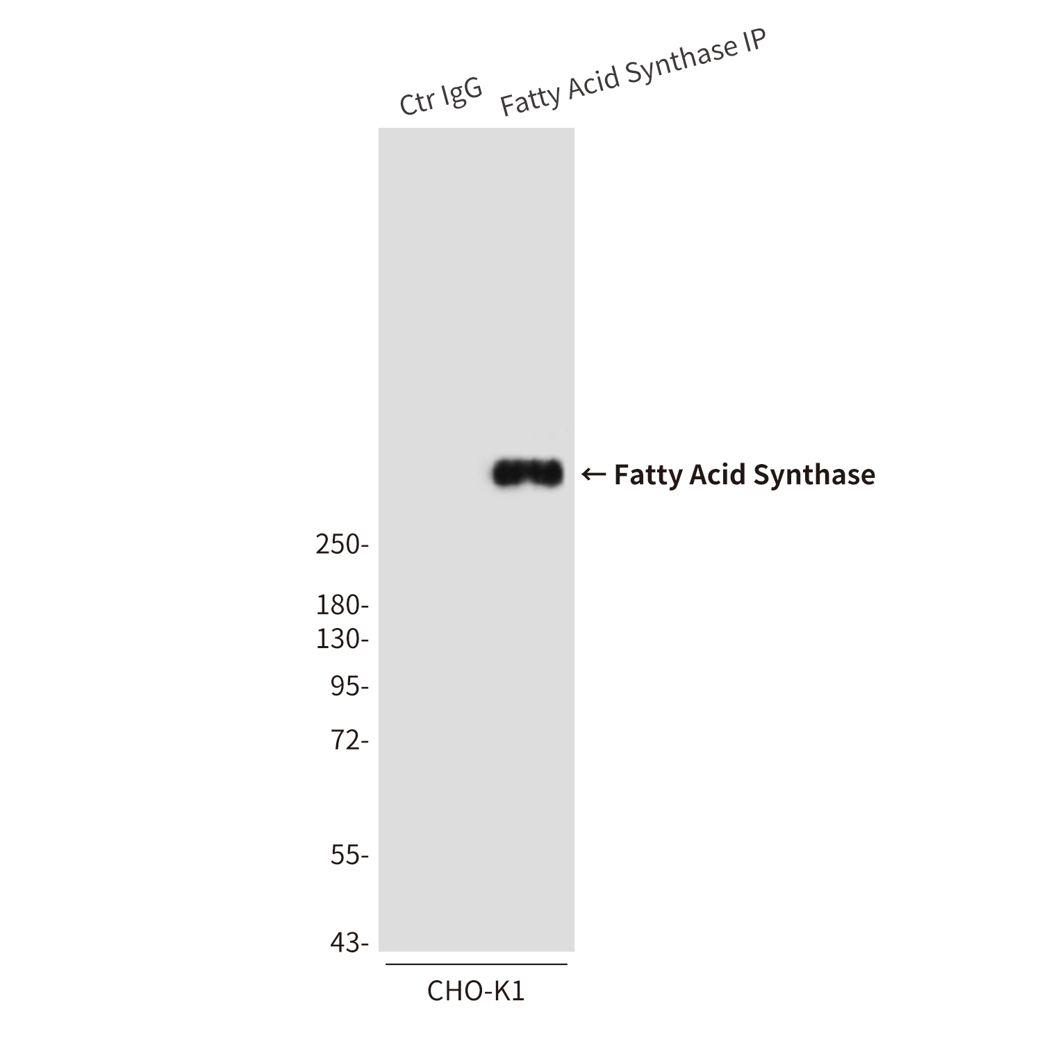 Fatty Acid Synthase (2F9) Mouse mAb ABZ3957