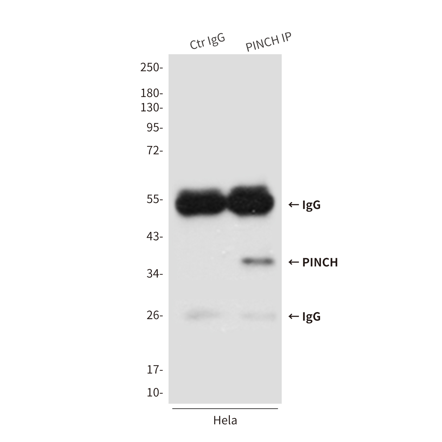 PINCH (3C12) Mouse mAb ABZ3958