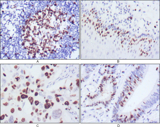 Ki67 (10B6) Mouse mAb ABZ3960