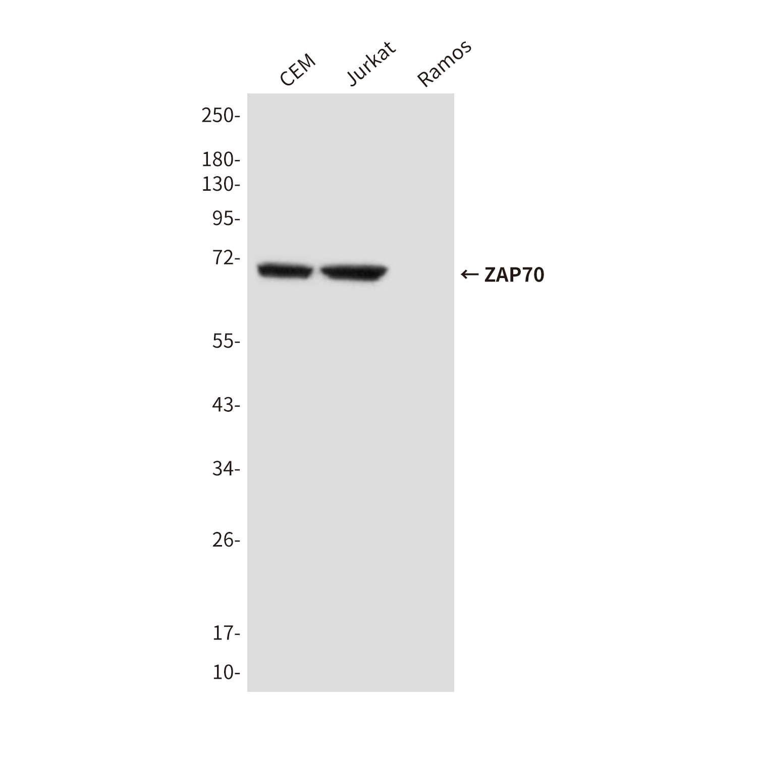 ZAP70 (4B2) Mouse mAb ABZ3965