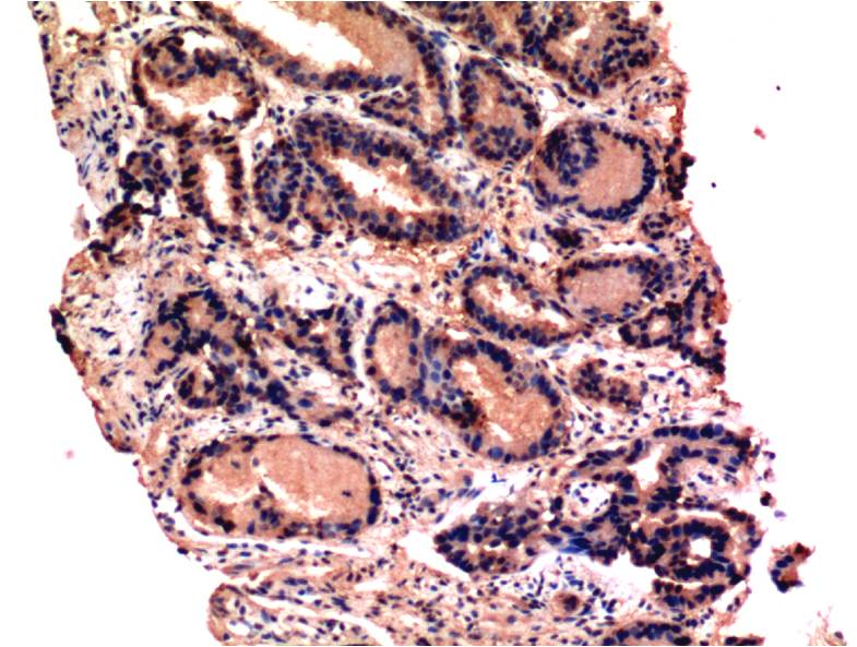 Caspase 3 (5H3) Mouse mAb ABZ3966