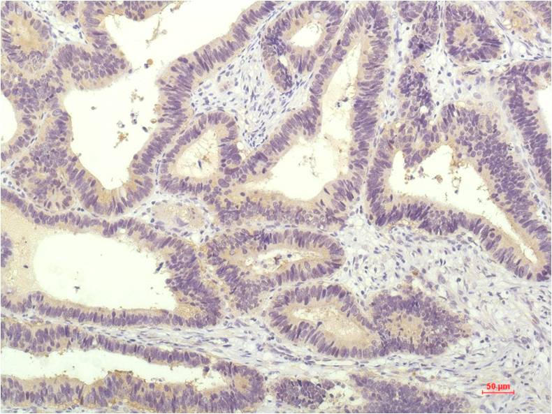 STAT1 (9D6) Mouse mAb ABZ3969