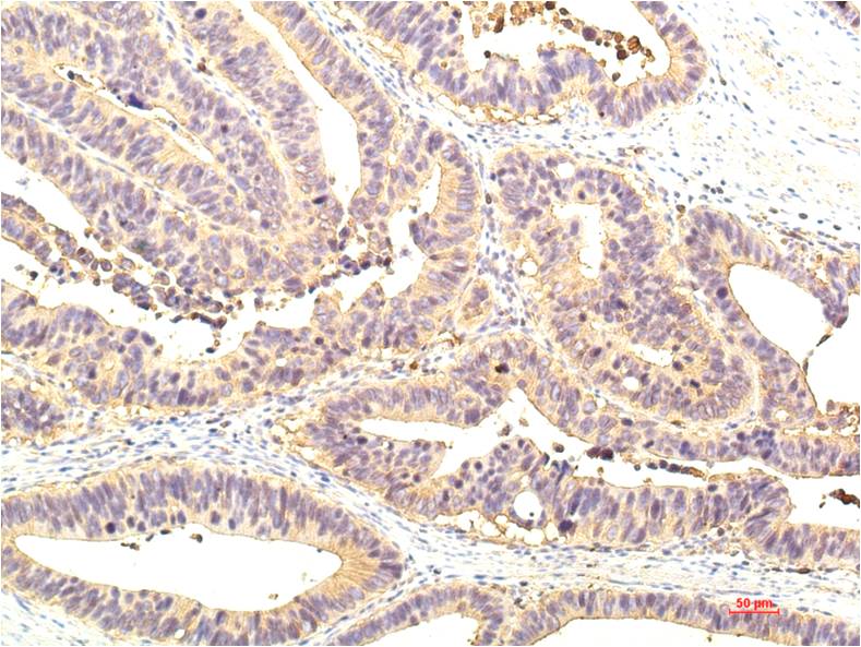 STAT1 (10F1) Mouse mAb ABZ3970