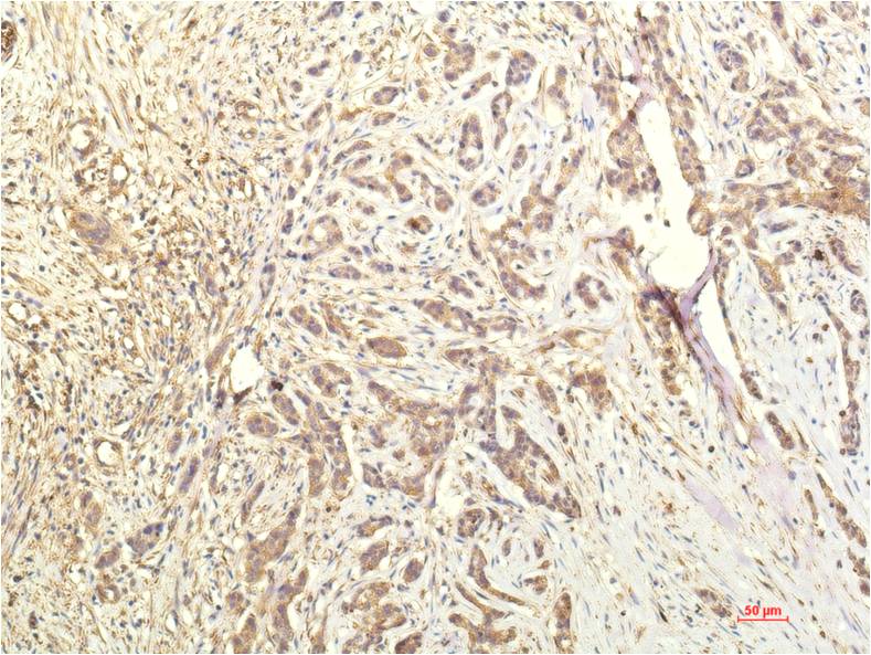 STAT1 (10F1) Mouse mAb ABZ3970