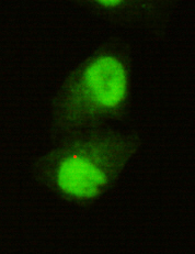 KDM5C (2E4) Mouse mAb ABZ3972